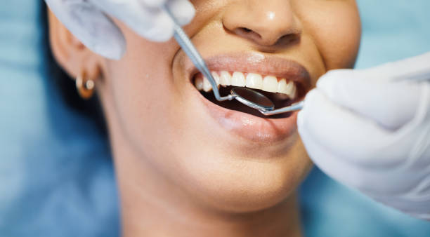 Best Emergency Root Canal Treatment in West Salem, OH